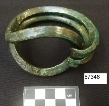 Sussex loop after treatment