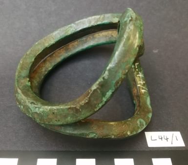 Sussex loop before surface cleaning